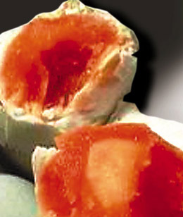 綜述：食品安全事件如割韭菜一茬接一茬